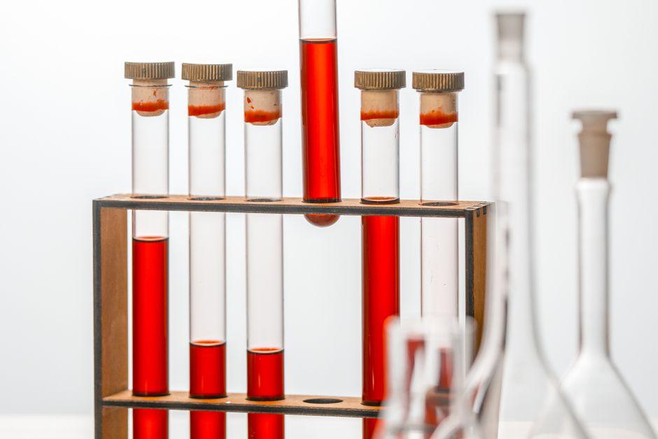 Don’t Dilute Your Results: A Guide to Custom Peptide Dilution Ratios